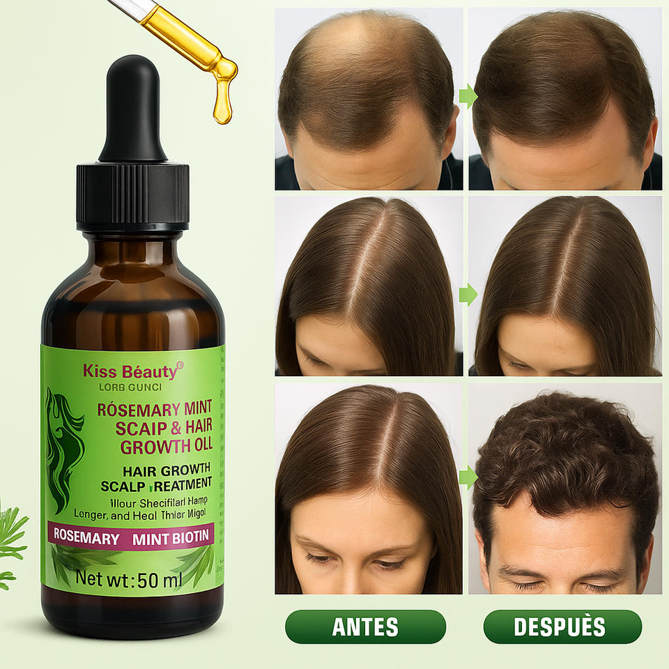 “Aceite de Romero con Biotina – Crecimiento Capilar Natural y Eficaz”