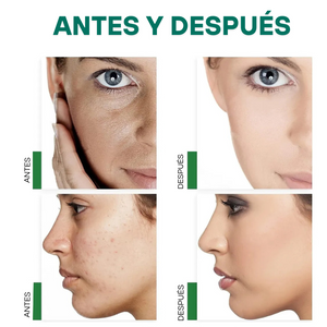 Máscara de arcilla verde