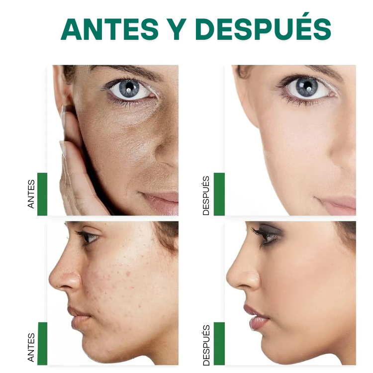 Máscara de arcilla verde